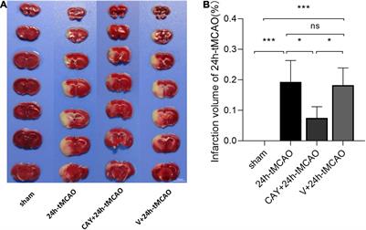 Inhibiting Sphingosine 1-Phosphate Receptor Subtype 3 Attenuates Brain Damage During Ischemia-Reperfusion Injury by Regulating nNOS/NO and Oxidative Stress